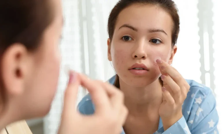 Woman applying a hydrocolloid pimple patch to a blemish while looking in a mirror