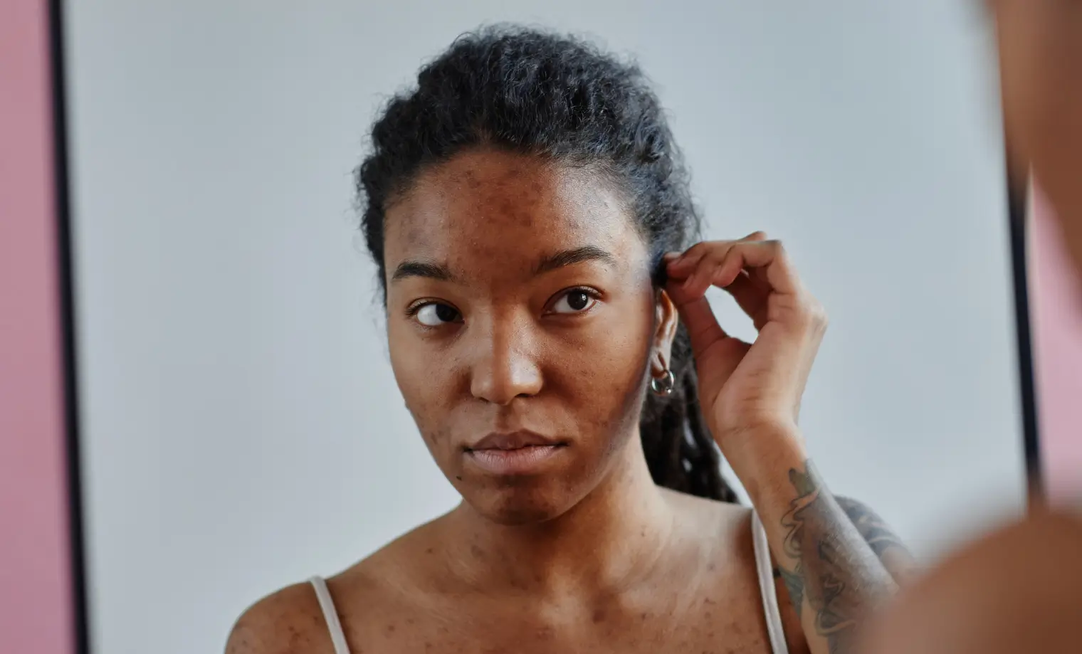 Woman with acne-prone skin examining her face in a mirror.